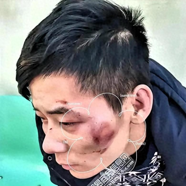 太猖狂！四川凌晨追打事件后续：6人一锅端，被查女子蛮横袭警